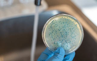 Contaminação Cruzada
